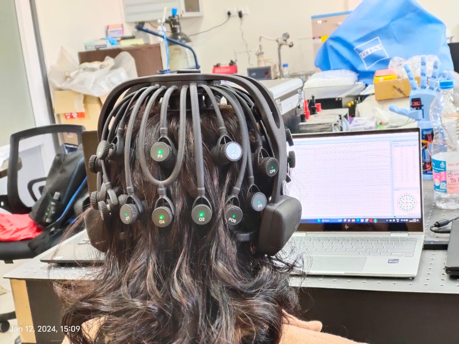 EEG-assisted prosthetic actuation work in the laboratory.